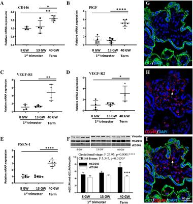 Expression of placental CD146 is dysregulated by prenatal alcohol exposure and contributes in cortical vasculature development and positioning of vessel-associated oligodendrocytes